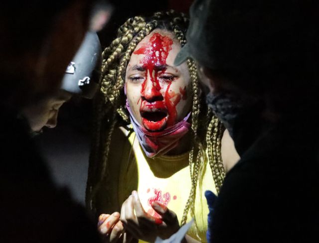 Black America can’t take it any more