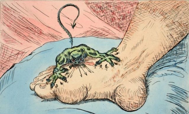 Gout is not karma for the sin of greed. Credit: Historica Graphica Collection/Heritage Images/Getty Images