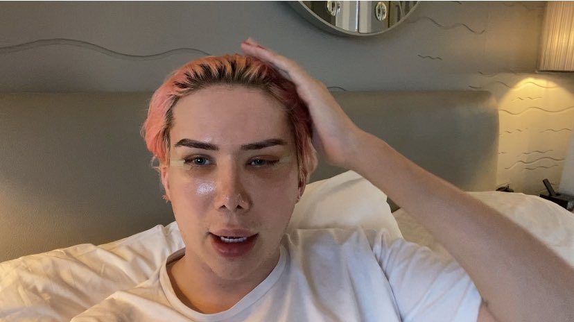 Oli London strikes poses for the camera after surgery, with the caption “New hair, new teeth, new eyes, new forehead- new me”