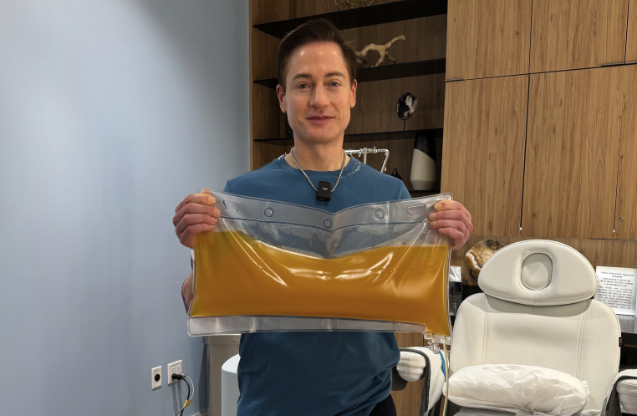 Johnson completed his first total plasma exchange with his son this week. Credit: Bryan Johnson